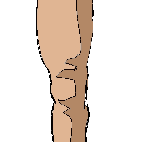 knee (5 strokes)