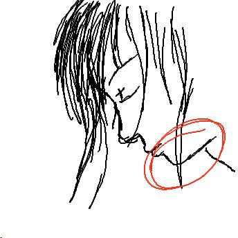 Kinn