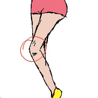 Knie