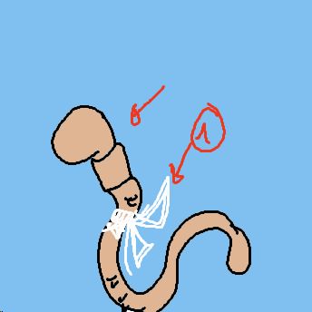 Bandwurm