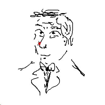 pickel