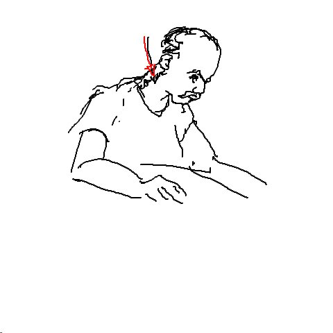 Genick
