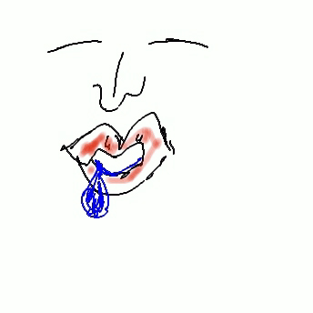 Speiche